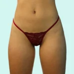 Tanga brasilera Milán